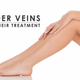 Illustration for article titled What Else Is There On Spider Veins Des Plaines?em/em